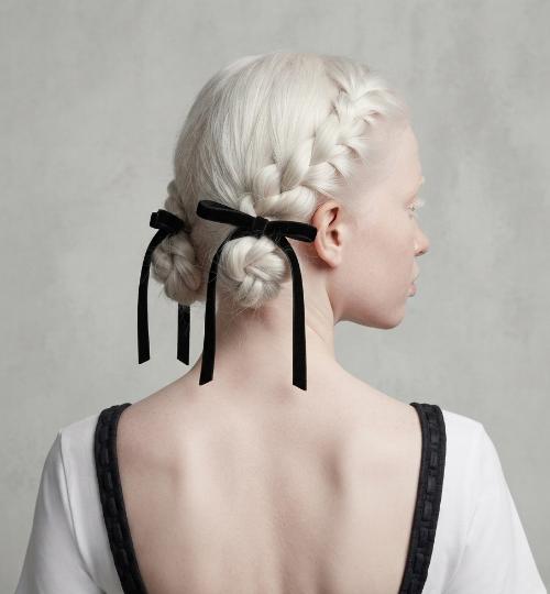hairstyles for albino hair