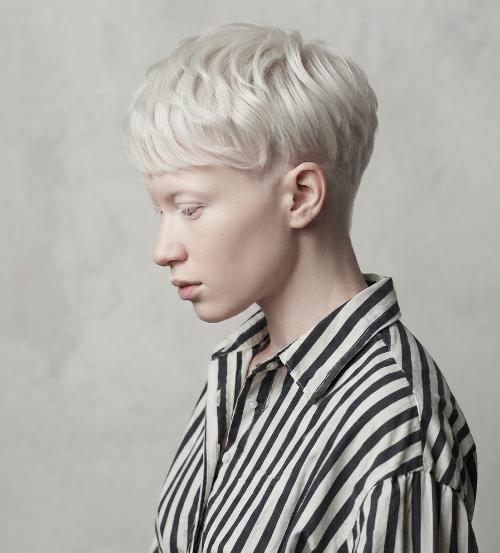 Pixie Haircut for Women with Albinism