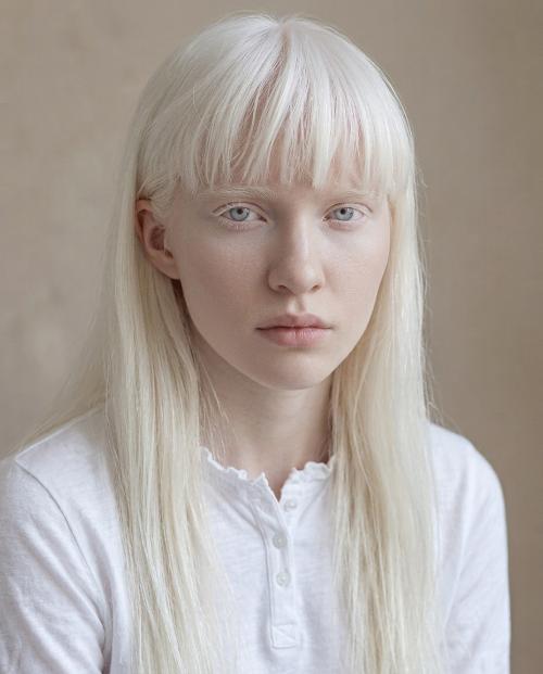 what is albino hair and albino hair care guide