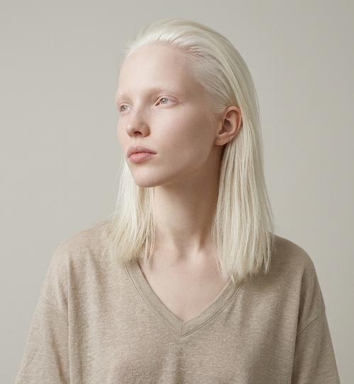 medium-length albino hair