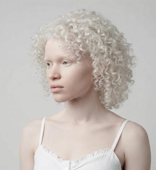 Top Haircuts and Hair Colors for Women with Albinism