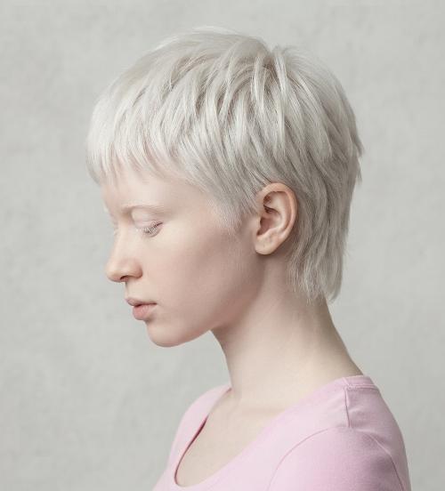 Best Hairstyles and Hair Colors for Women with Albinism